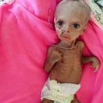 Carruurta Ku Nool Gobolka Tigray Ee Dalka Ethiopia oo Soo Wajahday Nafaqo Darro Ba’an